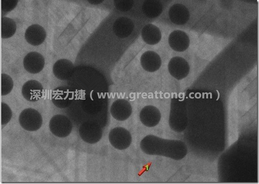 BGA因為焊墊變小，造成錫膏過多而最終形成焊接短路的結(jié)果。